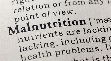 disclaimer (2024) rockfile.eu|Nigeria seeks stronger partnership with EU to combat malnutrition.